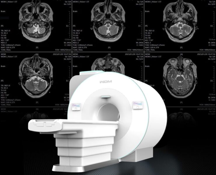 i_Vision 1.5T RMN fara Heliu