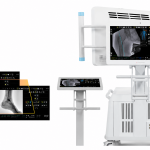 Angiograf-mobil-Euroampli-Alien-X-3D-echipamente-imagistica-medicala-clinici-si-spitale-MG-Medical-Ecoline